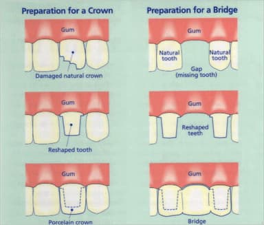 Dental care for children