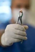 Dentist preparing for a tooth extraction